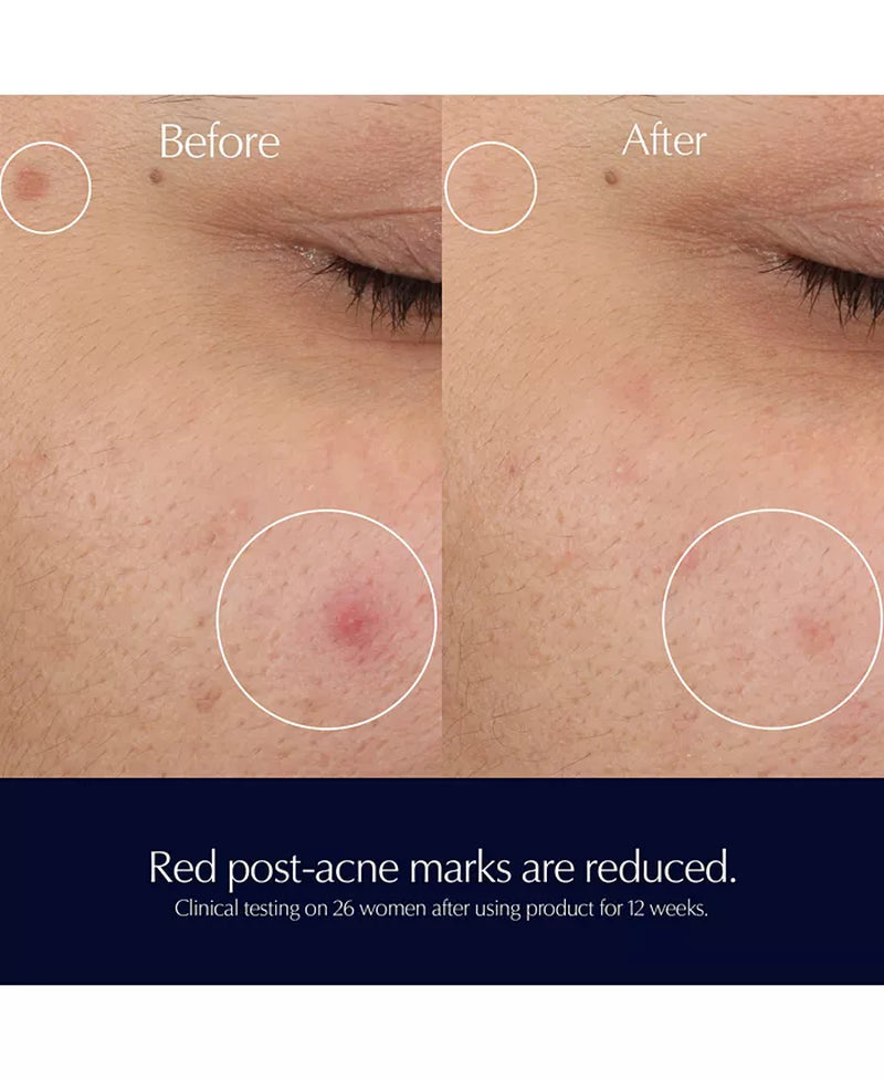Advanced Night Repair Rescue Solution Serum with 15% Bifidus Ferment, 0.68 Oz.
