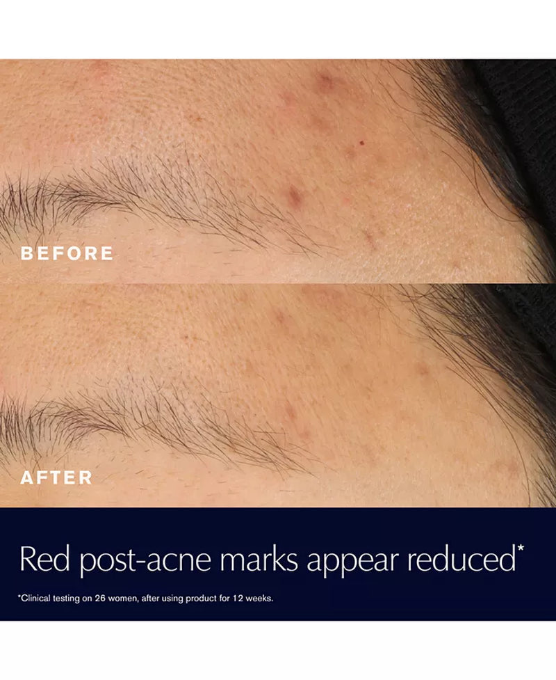 Advanced Night Repair Rescue Solution Serum with 15% Bifidus Ferment, 0.68 Oz.