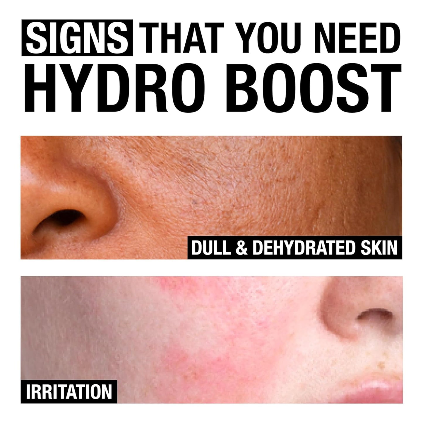 Hydro Boost Hydrating Gel Cleanser, Face Wash & Makeup Remover, Gentle Facial Cleanser with Hyaluronic Acid, Hypoallergenic, Oil-Free, Soap-Free, 7.8 Fl Oz