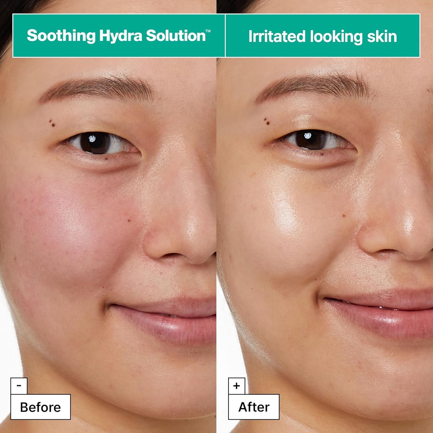 Dermask™ Soothing Hydra Solution™ Face Mask for Visibly Irritated Skin | Sheet Mask | Korean Skin Care