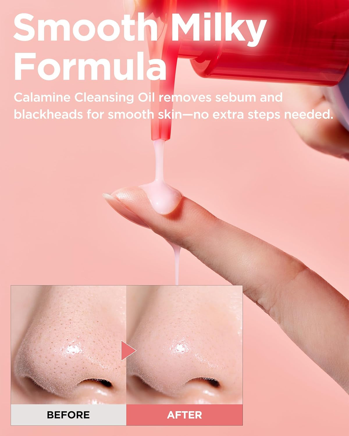 Calamine Pore Control Cleansing Oil 200Ml / 6.76 Fl Oz | Blackheads, Make-Up Cleansing, Pore Care, Deep Cleansing, Mothers Day